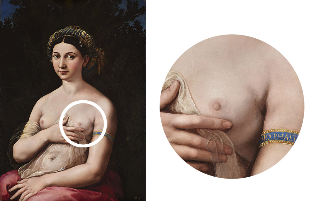 L’Iconodiagnostic : quand la médecine rencontre l’histoire de l’art 3 L’Iconodiagnostic : quand la médecine rencontre l’histoire de l’art 1